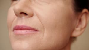Frau mit Lippenfalten