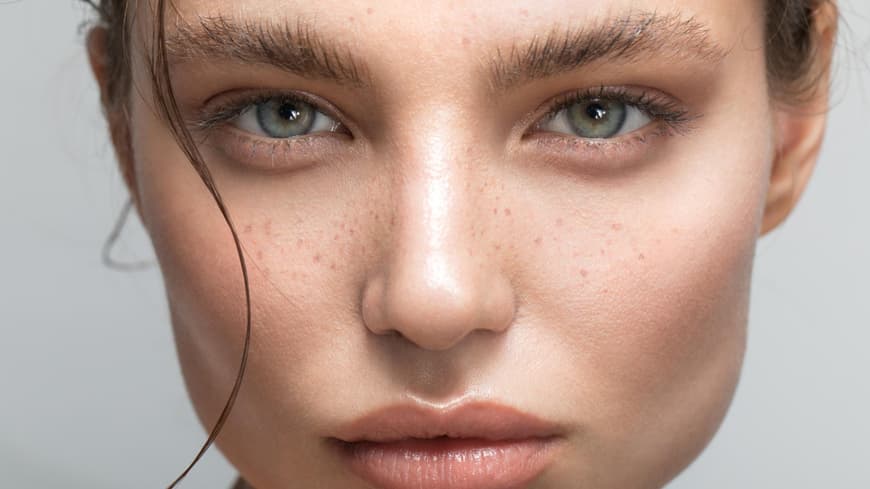 Brow Lifting