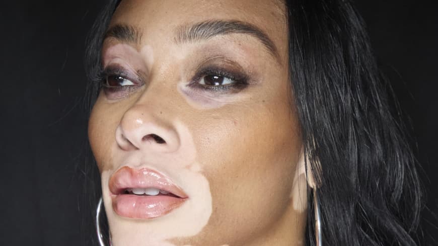 Winnie Harlow mit perfekten Augenbrauen