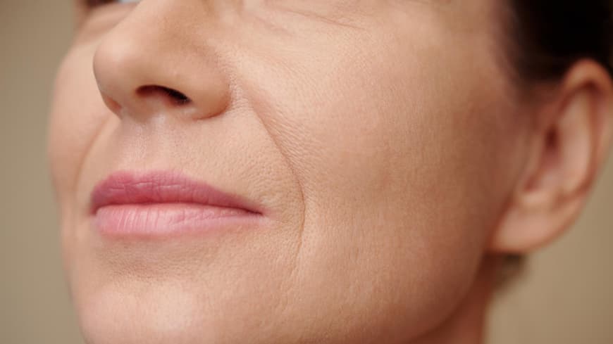 Frau mit Lippenfalten
