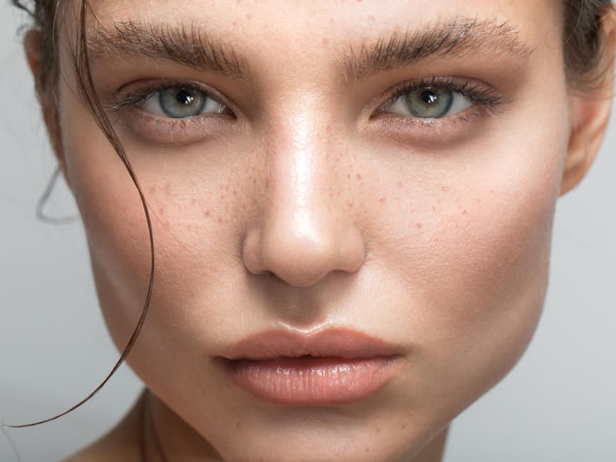 Brow Lifting