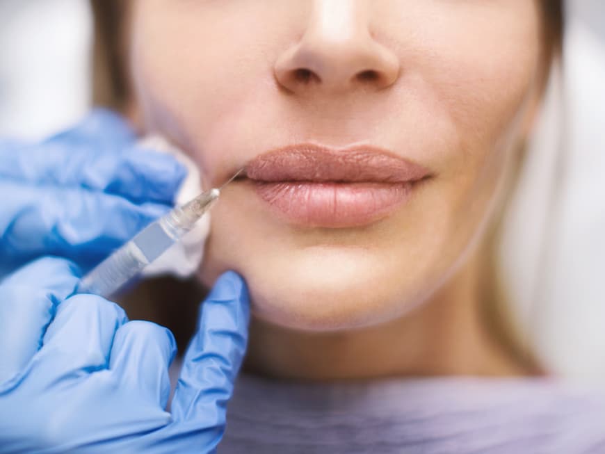 Frau lässt sich Lippen aufspritzen