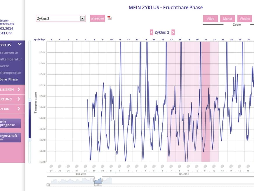 Software Kurven_© VivoSensMedical
