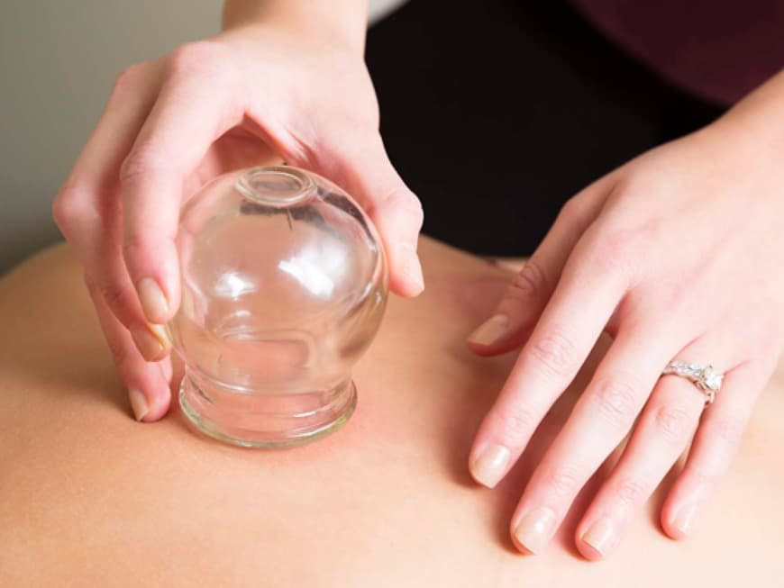 cupping